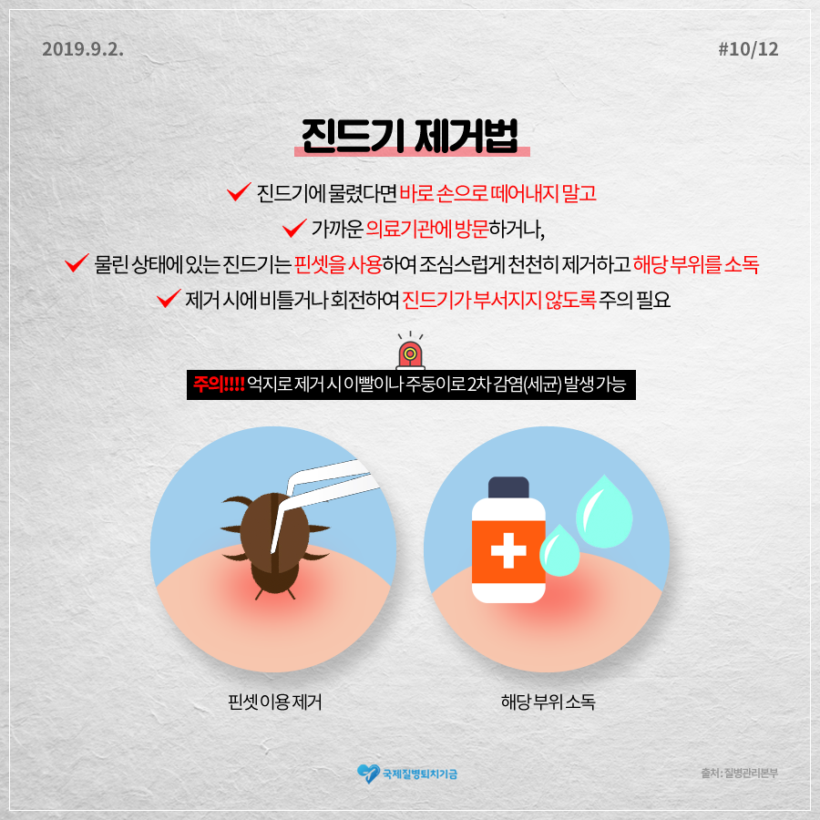 손으로 제거 하면 안돼요~~예